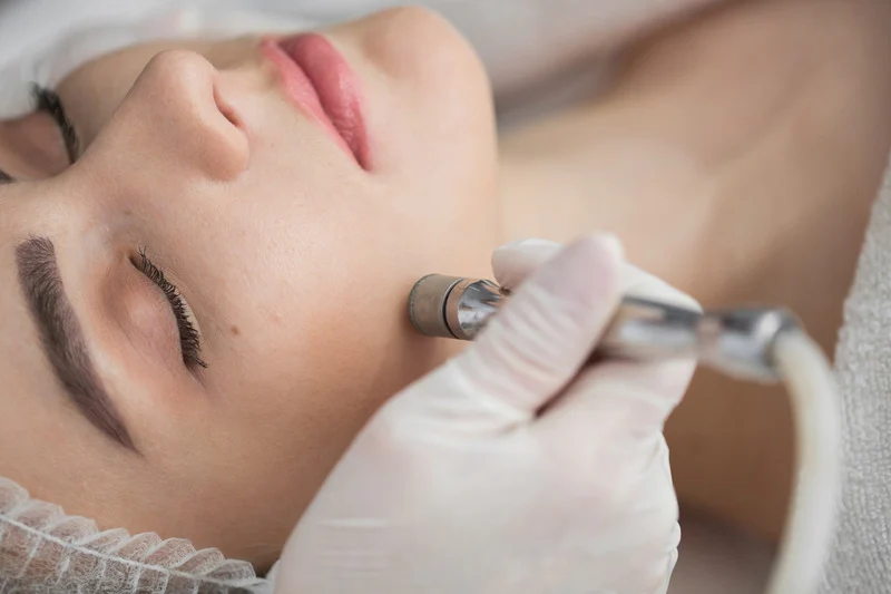 Microdermabrasion Express Facial